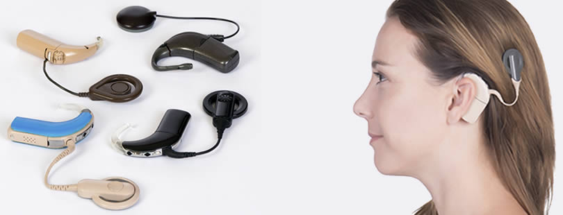 Cochlear Implants